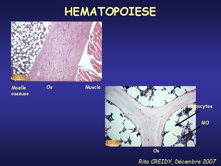 HEMATOPOIESE Moelle osseuse Os Muscle adipocytes MO Os Rita CREIDY, Décembre 2007 