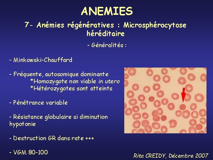 ANEMIES 7 - Anémies régénératives : Microsphérocytose héréditaire - Généralités : - Minkowski-Chauffard -