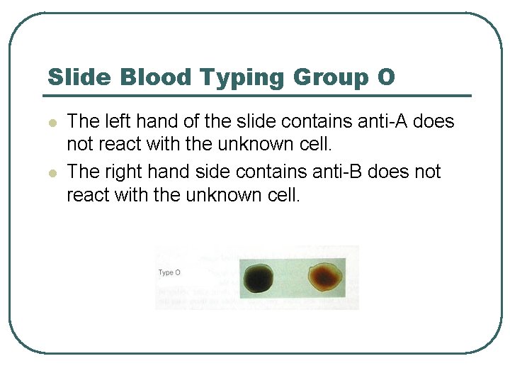 Slide Blood Typing Group O l l The left hand of the slide contains