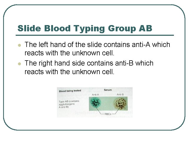 Slide Blood Typing Group AB l l The left hand of the slide contains