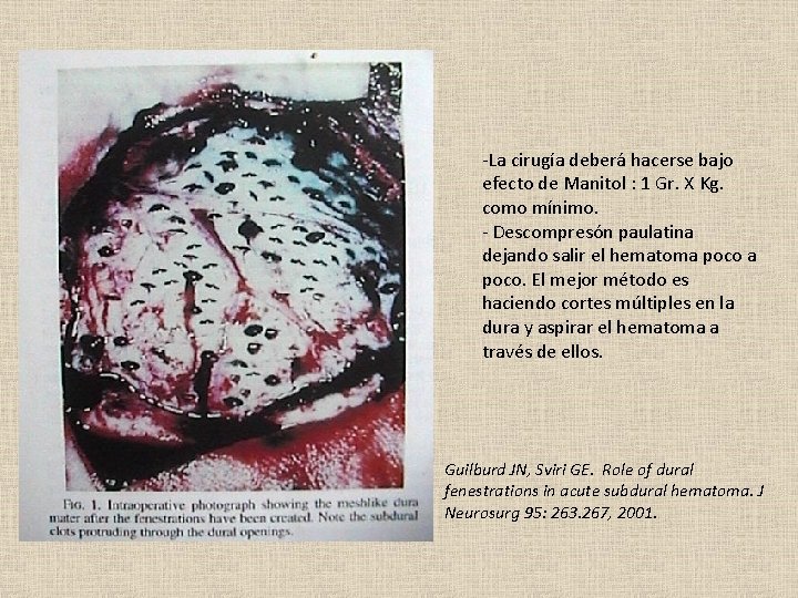 -La cirugía deberá hacerse bajo efecto de Manitol : 1 Gr. X Kg. como