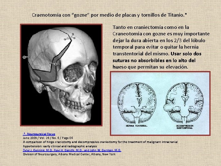 Craenotomía con “gozne” por medio de placas y tornillos de Titanio. * Tanto en
