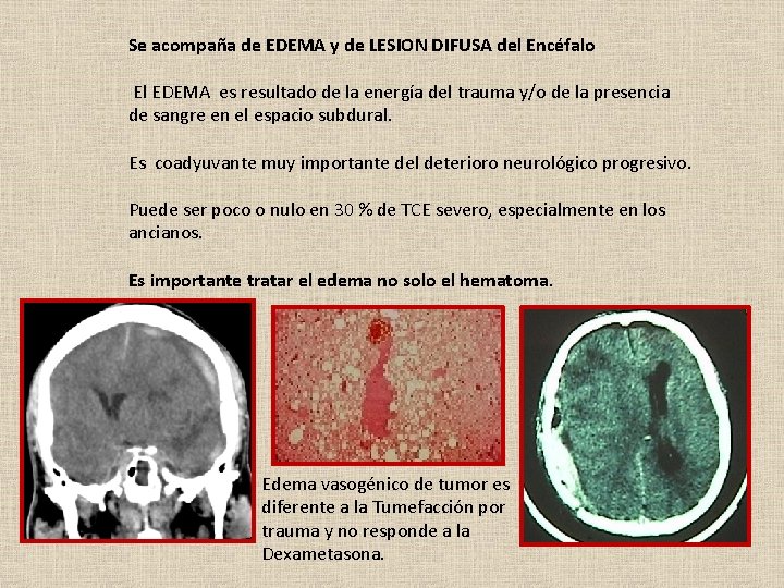 Se acompaña de EDEMA y de LESION DIFUSA del Encéfalo El EDEMA es resultado
