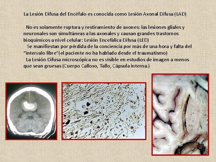 La Lesión Difusa del Encéfalo es conocida como Lesión Axonal Difusa (LAD) No es