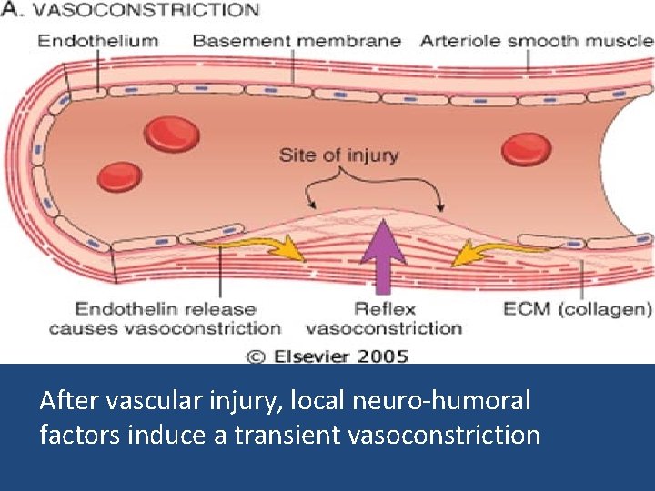 After vascular injury, local neuro-humoral factors induce a transient vasoconstriction 