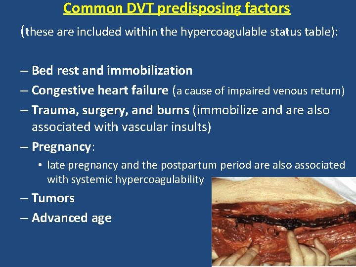 Common DVT predisposing factors (these are included within the hypercoagulable status table): – Bed