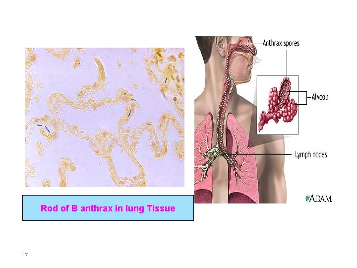 Rod of B anthrax in lung Tissue 17 