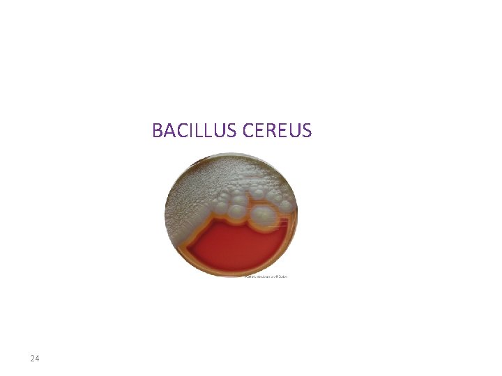 BACILLUS CEREUS 24 
