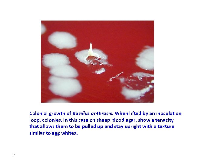Colonial growth of Bacillus anthracis. When lifted by an inoculation loop, colonies, in this