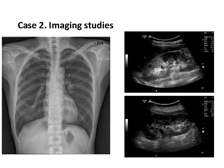 Case 2. Imaging studies 