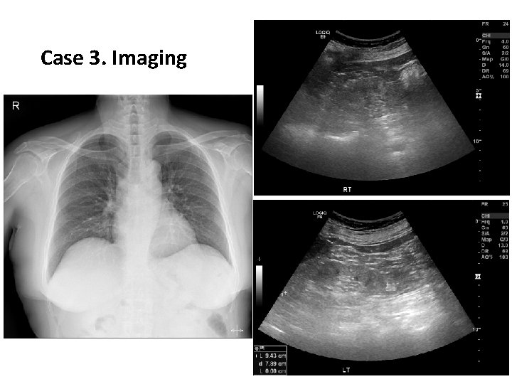 Case 3. Imaging 