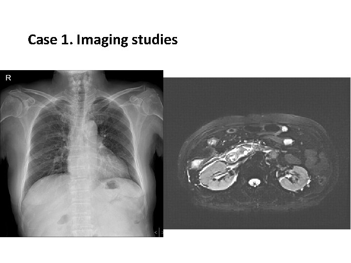 Case 1. Imaging studies 