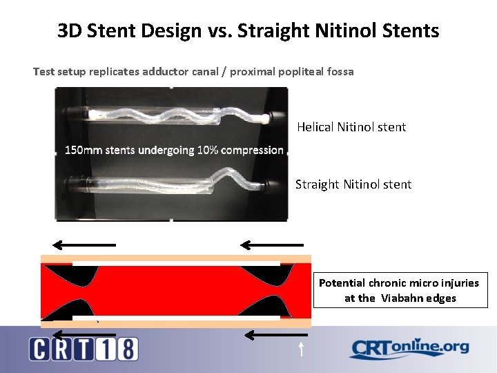 3 D Stent Design vs. Straight Nitinol Stents Test setup replicates adductor canal /