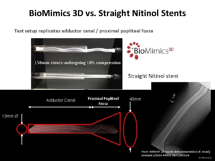 Bio. Mimics 3 D vs. Straight Nitinol Stents Test setup replicates adductor canal /