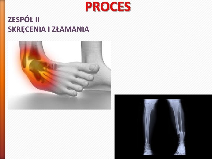 PROCES ZESPÓŁ II SKRĘCENIA I ZŁAMANIA 