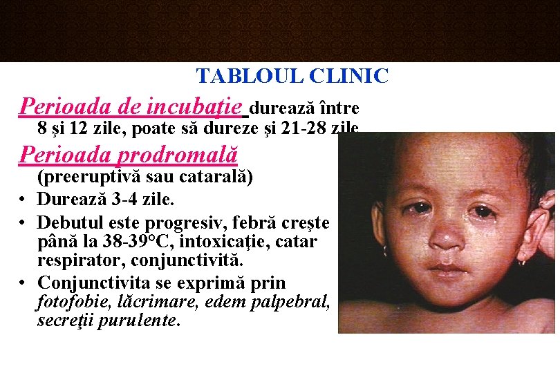 TABLOUL CLINIC Perioada de incubaţie durează între 8 şi 12 zile, poate să dureze