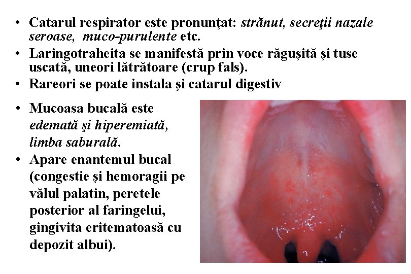  • Catarul respirator este pronunţat: strănut, secreţii nazale seroase, muco-purulente etc. • Laringotraheita