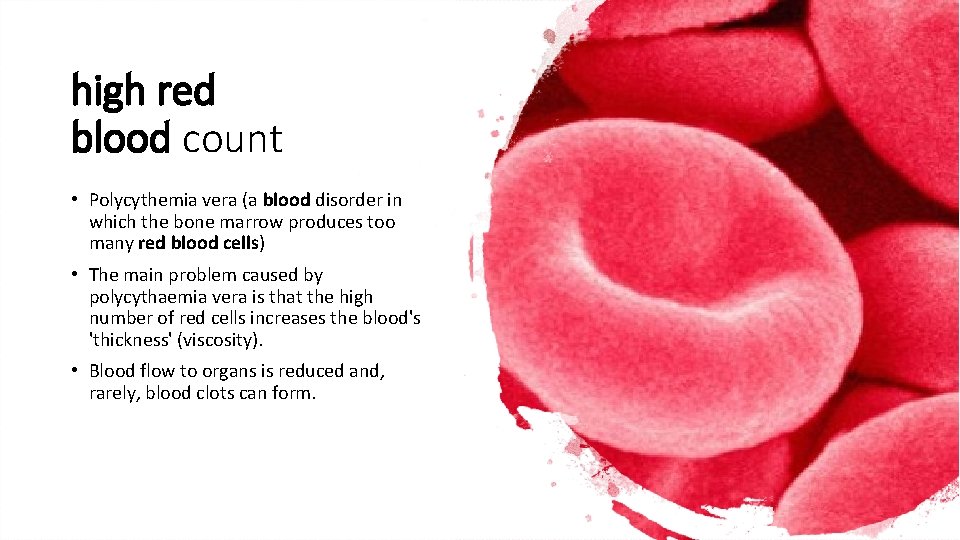 high red blood count • Polycythemia vera (a blood disorder in which the bone