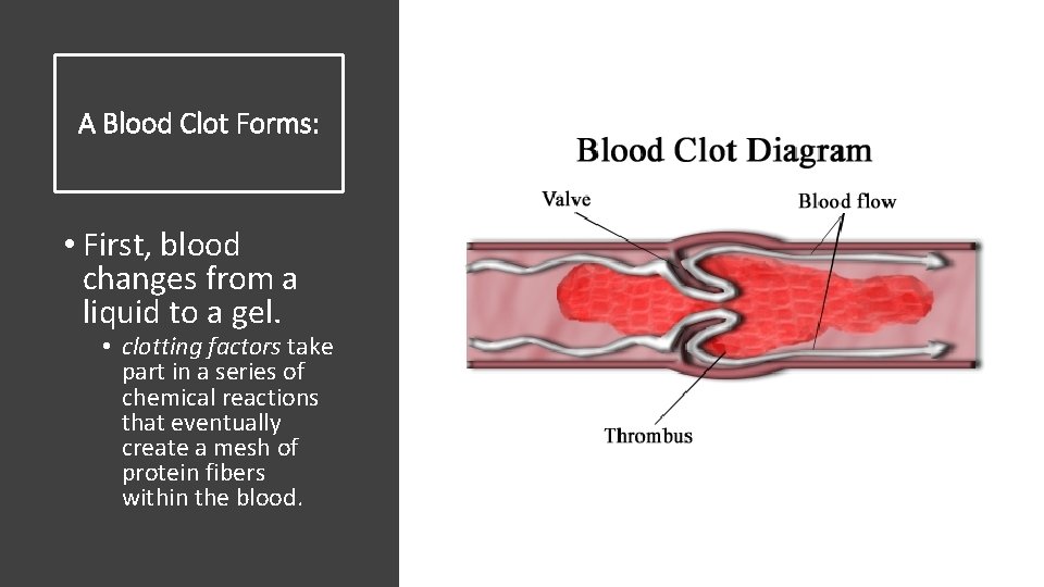 A Blood Clot Forms: • First, blood changes from a liquid to a gel.