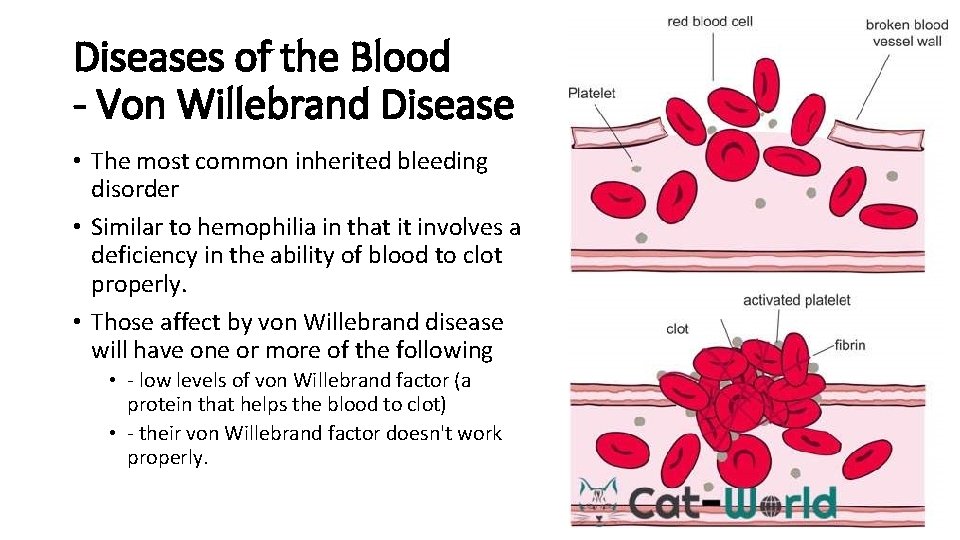 Diseases of the Blood - Von Willebrand Disease • The most common inherited bleeding