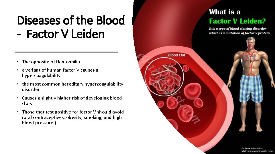 Diseases of the Blood - Factor V Leiden • The opposite of Hemophilia •