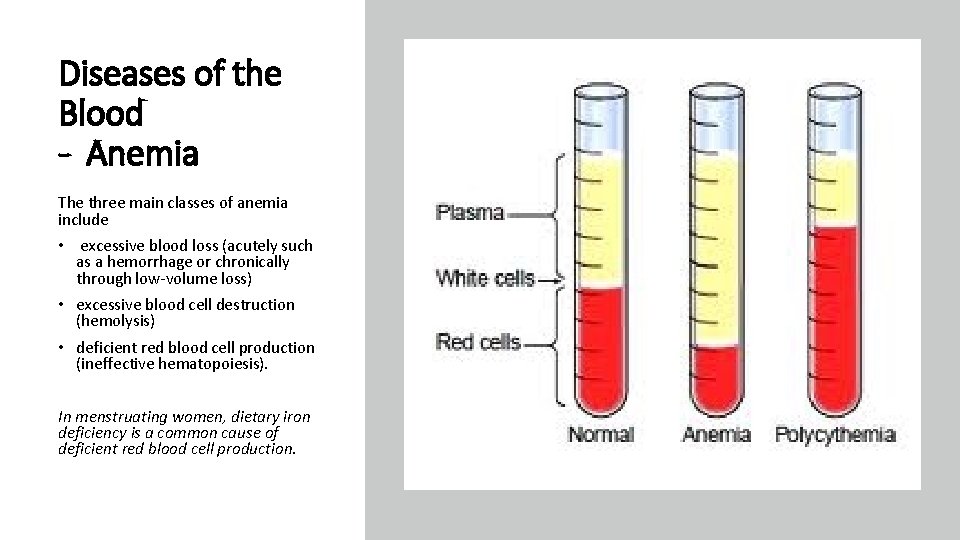 Diseases of the Blood - Anemia The three main classes of anemia include •