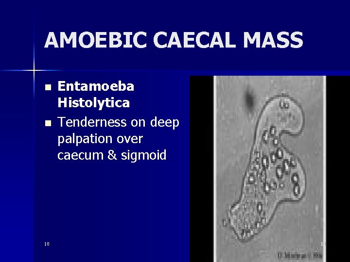 AMOEBIC CAECAL MASS n n 10 Entamoeba Histolytica Tenderness on deep palpation over caecum