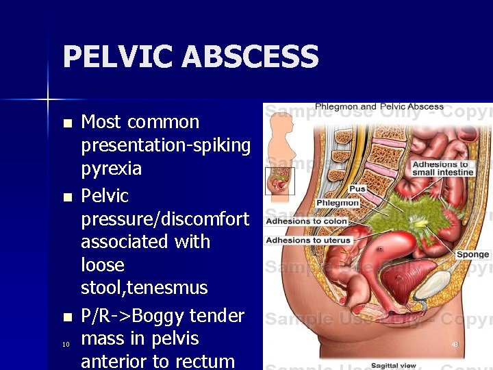 PELVIC ABSCESS n n n 10 Most common presentation-spiking pyrexia Pelvic pressure/discomfort associated with