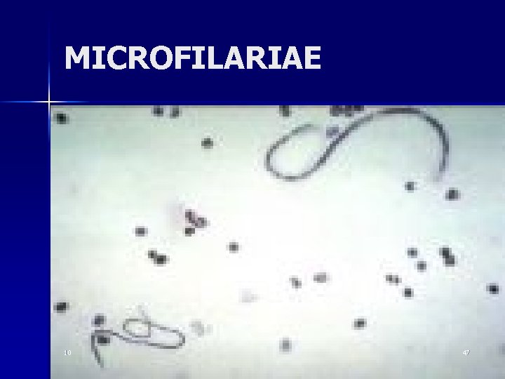 MICROFILARIAE 10 47 