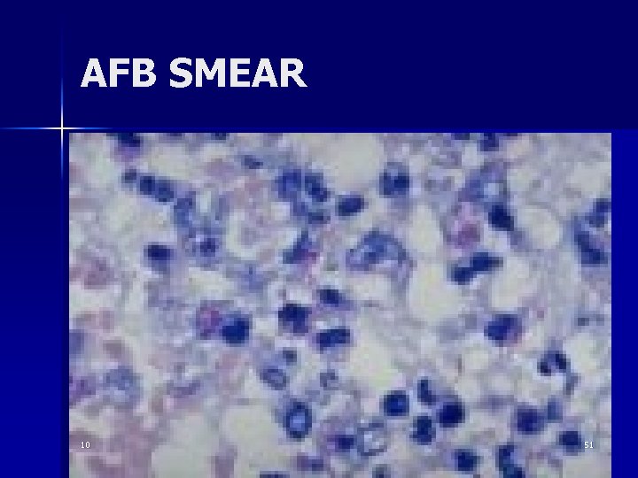 AFB SMEAR 10 51 