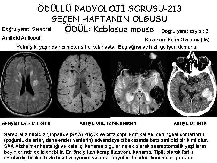 ÖDÜLLÜ RADYOLOJİ SORUSU-213 GEÇEN HAFTANIN OLGUSU Doğru yanıt: Serebral ÖDÜL: Kablosuz mouse Doğru yanıt