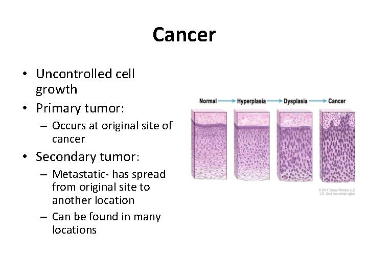 Cancer • Uncontrolled cell growth • Primary tumor: – Occurs at original site of