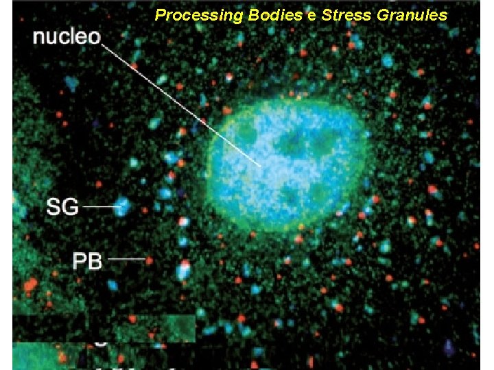 Processing Bodies e Stress Granules 