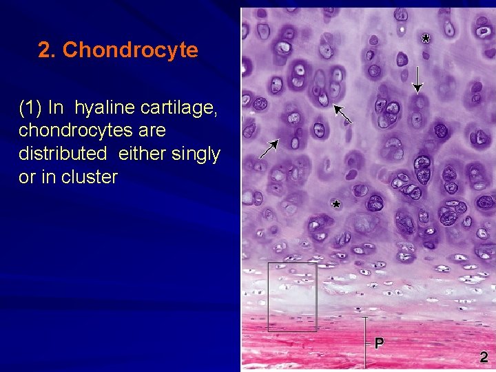 2. Chondrocyte (1) In hyaline cartilage, chondrocytes are distributed either singly or in cluster