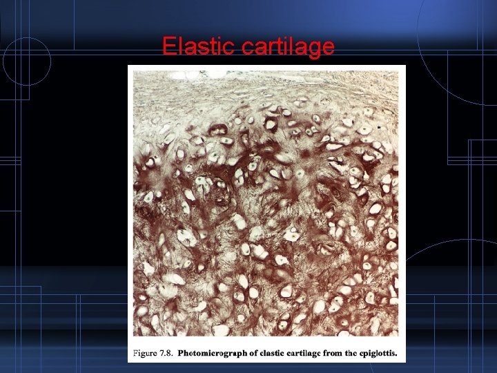 Elastic cartilage 