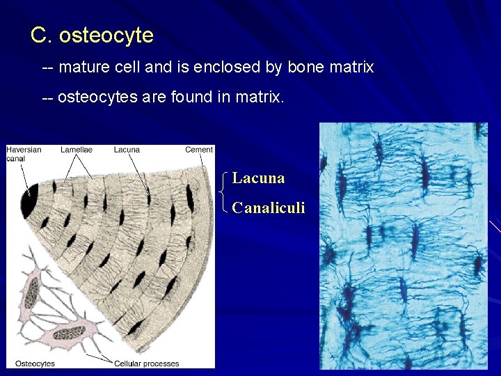 C. osteocyte -- mature cell and is enclosed by bone matrix -- osteocytes are