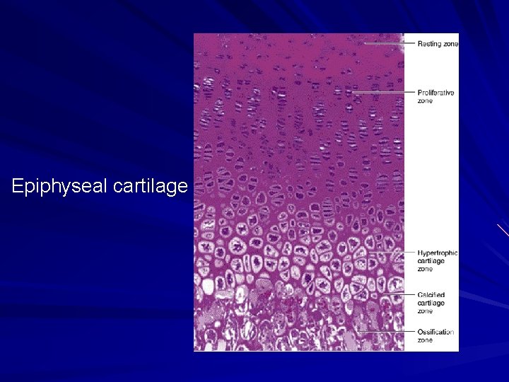 Epiphyseal cartilage 