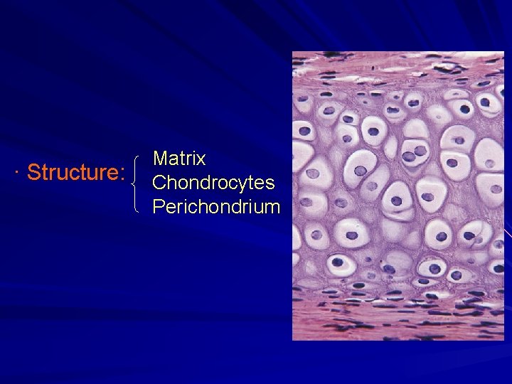 · Structure: Matrix Chondrocytes Perichondrium 