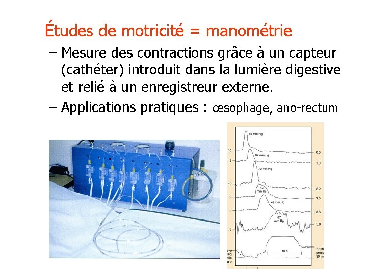 Études de motricité = manométrie – Mesure des contractions grâce à un capteur (cathéter)