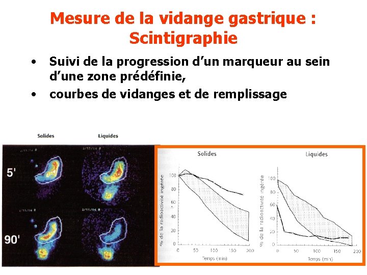 Mesure de la vidange gastrique : Scintigraphie • • Suivi de la progression d’un