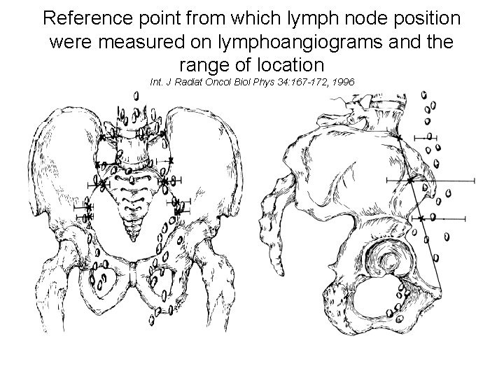 Reference point from which lymph node position were measured on lymphoangiograms and the range