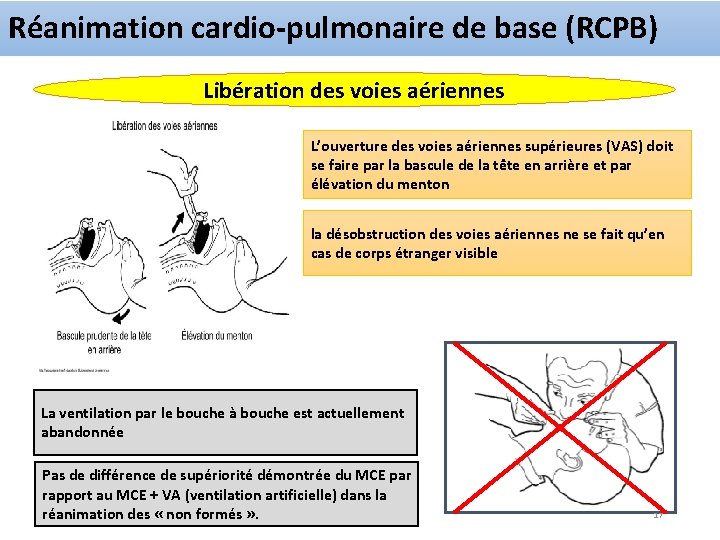 Réanimation cardio-pulmonaire de base (RCPB) Libération des voies aériennes L’ouverture des voies aériennes supérieures