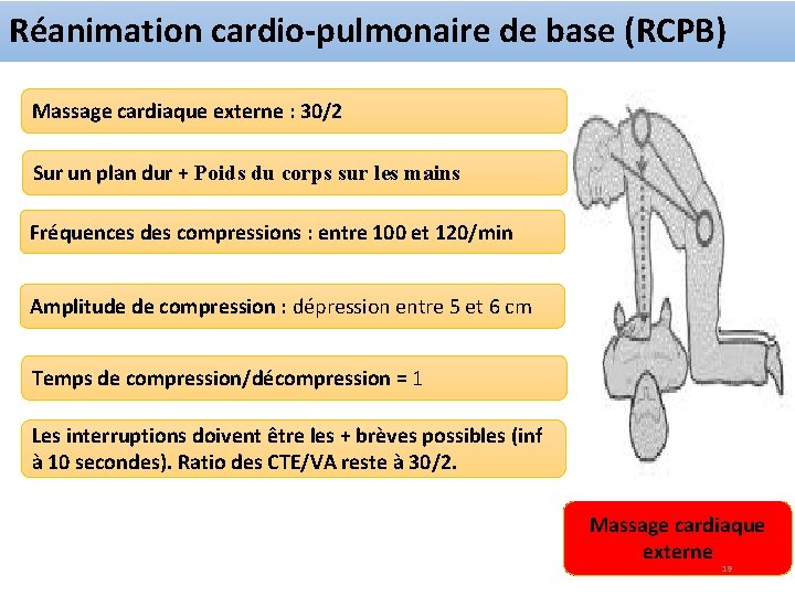 Réanimation cardio-pulmonaire de base (RCPB) Massage cardiaque externe : 30/2 Sur un plan dur