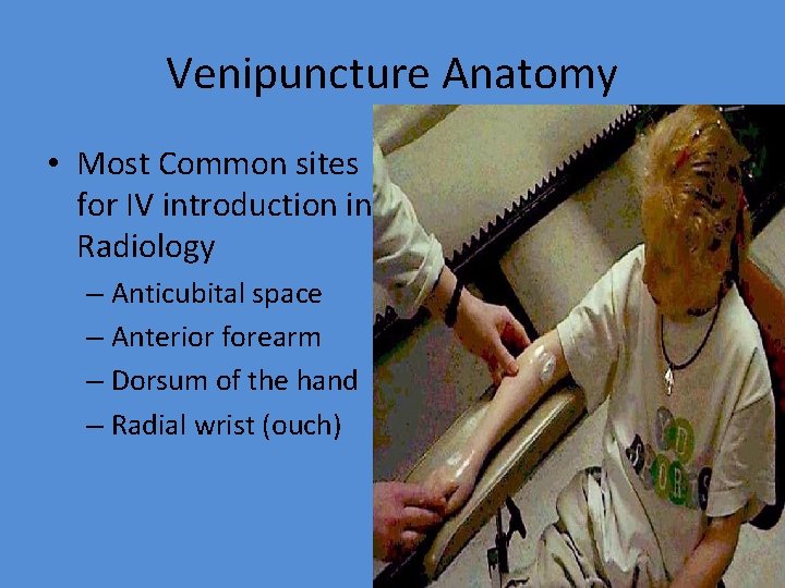 Venipuncture Anatomy • Most Common sites for IV introduction in Radiology – Anticubital space