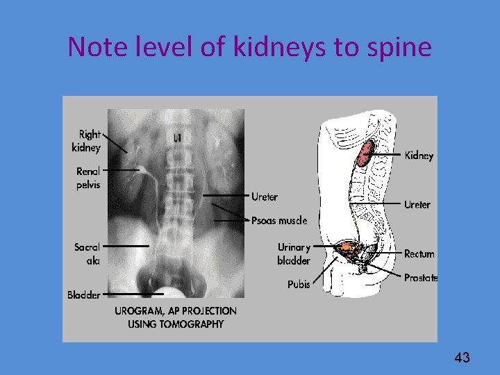 Note level of kidneys to spine 43 