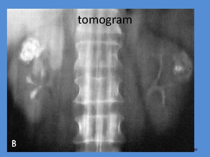 tomogram 48 