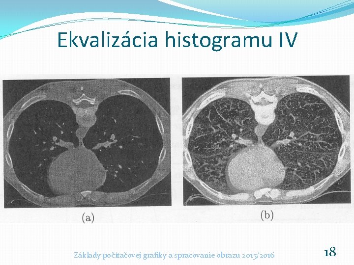 Ekvalizácia histogramu IV Základy počítačovej grafiky a spracovanie obrazu 2015/2016 18 