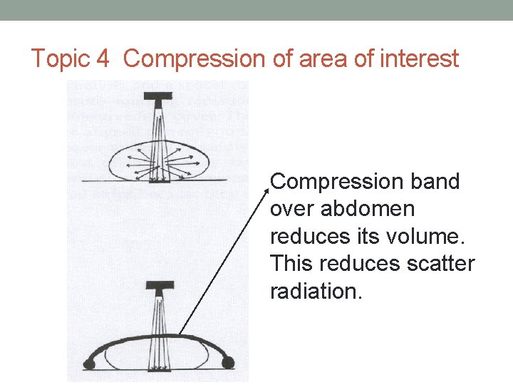 Topic 4 Compression of area of interest Compression band over abdomen reduces its volume.