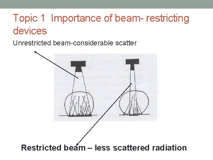 Topic 1 Importance of beam- restricting devices Unrestricted beam-considerable scatter Restricted beam – less