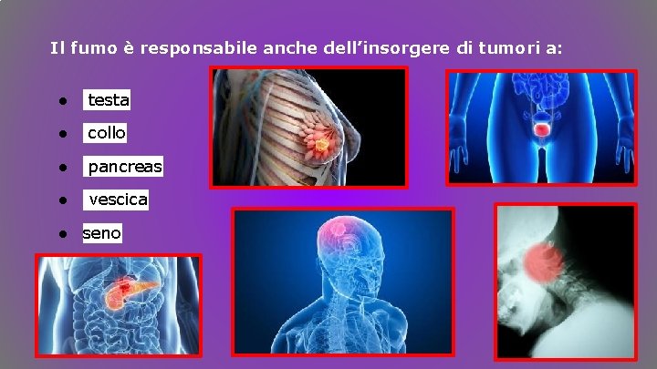 Il fumo è responsabile anche dell’insorgere di tumori a: ● testa ● collo ● Il fumo è responsabile anche dell’insorgere di tumori a: ● testa ● collo ●